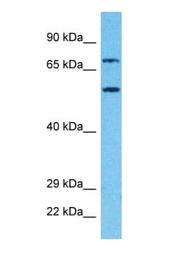 PRPF31 Antibody (C-Terminus, Biotin)