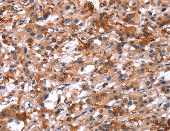 Polyclonal Rabbit anti-Human GCGR / Glucagon Receptor Antibody (IHC, WB)