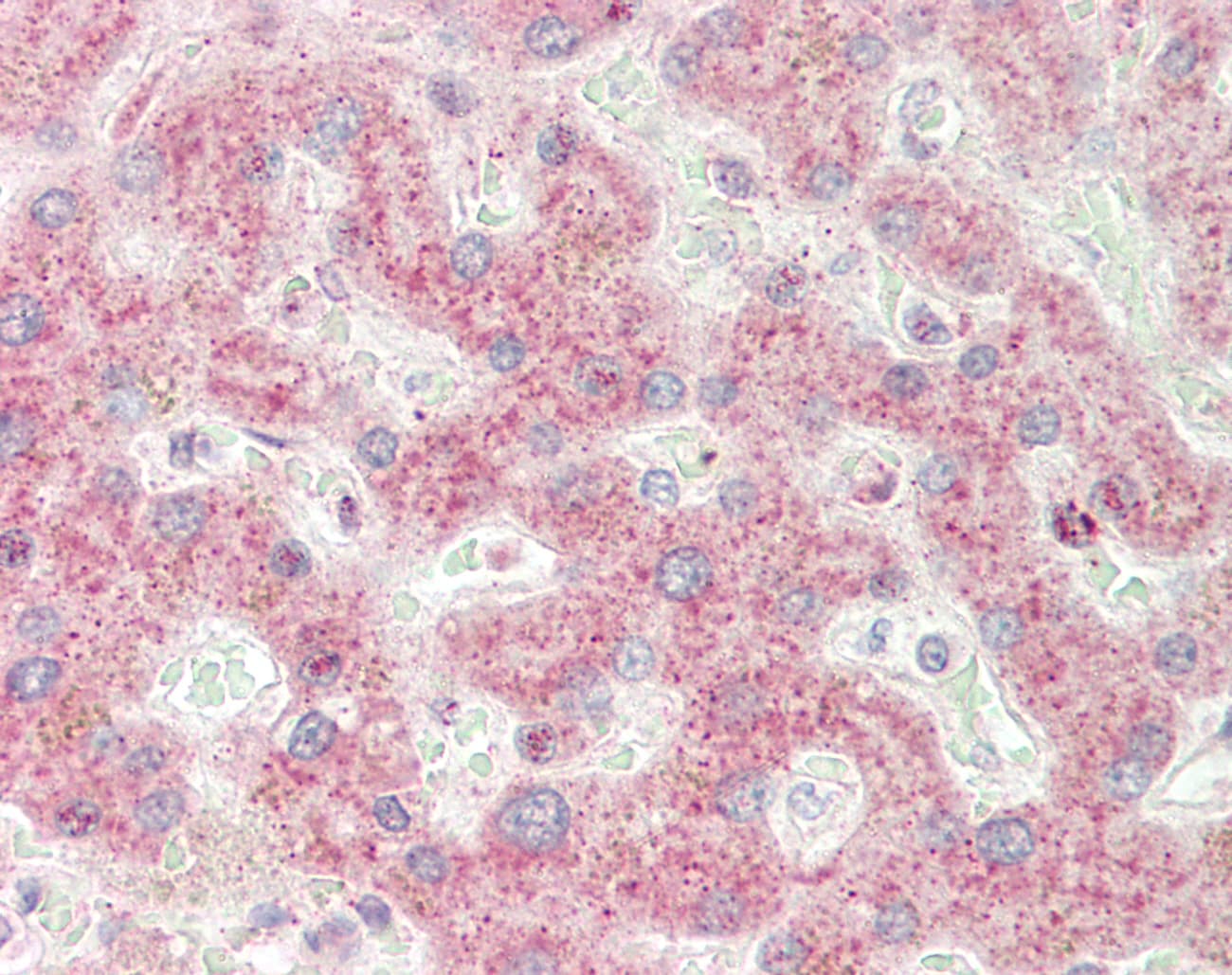 Polyclonal Rabbit anti-Human SPG21 / MAST Antibody (C-Terminus, IHC, WB)