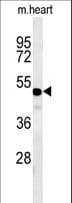 WDR18 Antibody (aa390-418)