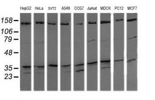 MAP2K3 / MEK3 / MKK3 Antibody (clone OTI2A7, Carrier-free)