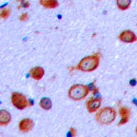 PTHR / PTHR1 Antibody (phospho-Thr1)