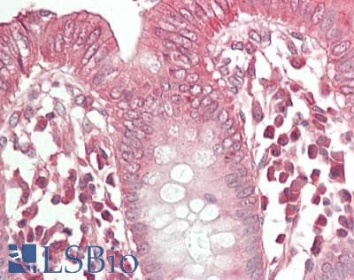 IHC-plus™ NGN / Neogenin Antibody (aa1411-1461)