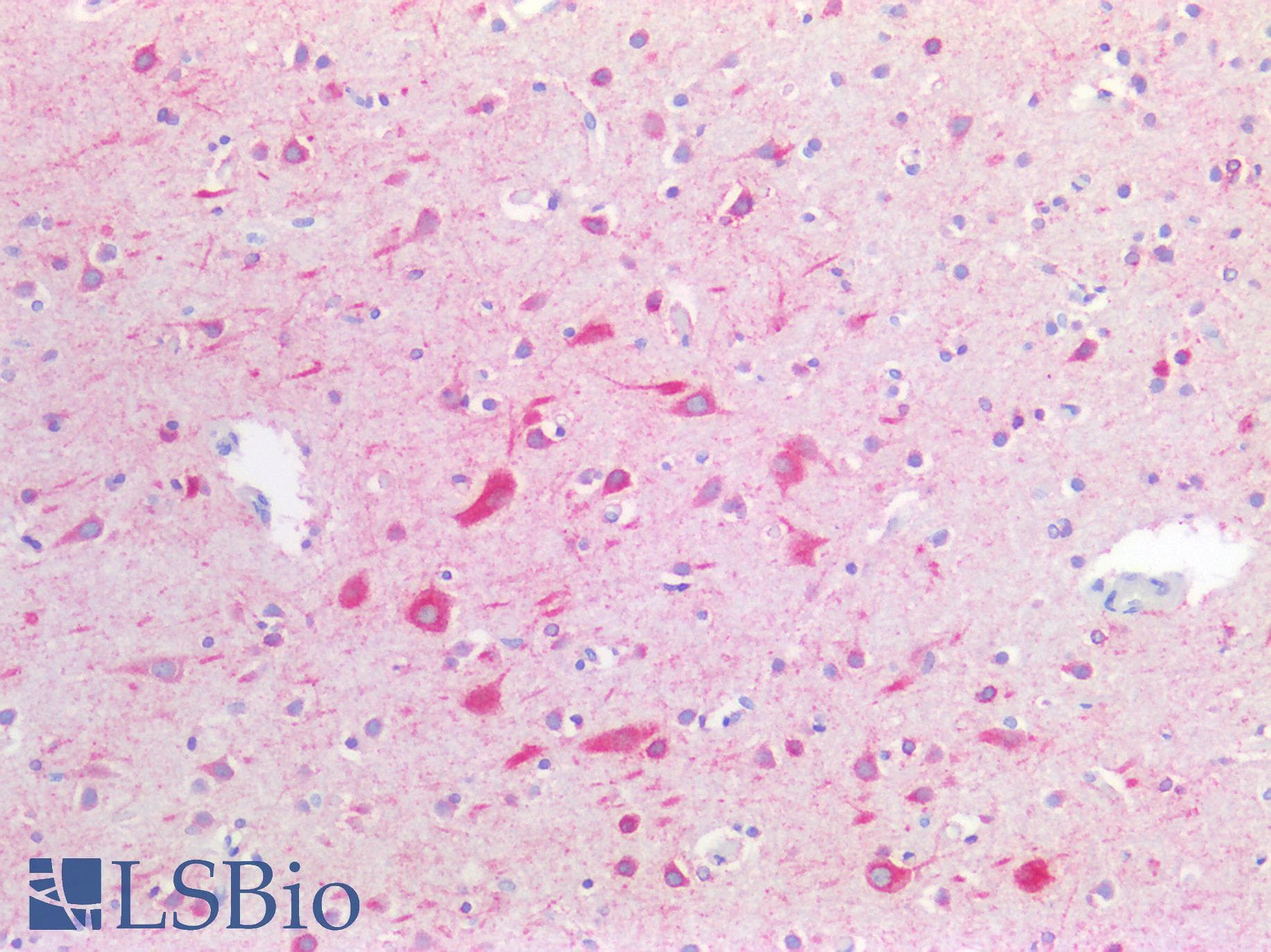 PathPlus™ CANX / Calnexin Antibody (C-Terminus)