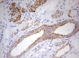 KRT7 / CK7 / Cytokeratin 7 Antibody (clone OTI1C5)