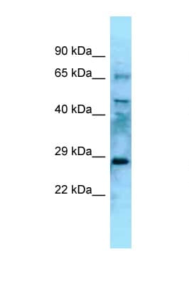 EYA4 Antibody (N-Terminus)