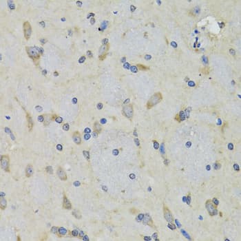 Polyclonal Rabbit anti-Human MRNP41 / RAE1 Antibody (IHC, IF, WB)