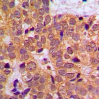 Polyclonal Rabbit anti-Human STAT1 Antibody (C-Terminus, IHC, WB)