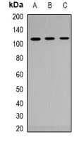 AR / Androgen Receptor Antibody (Internal)