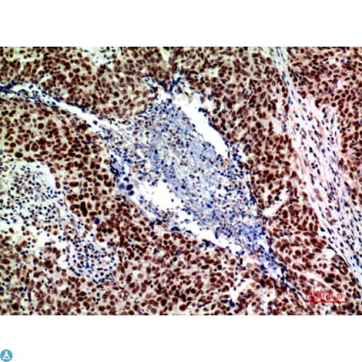 ACER2 Antibody