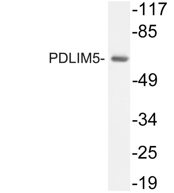 PDLIM5 / LIM Antibody (aa208-257)