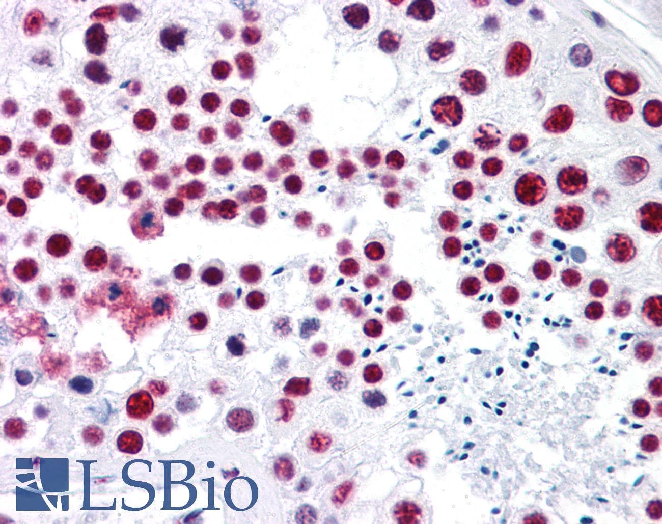 IHC-plus™ SNRPA / U1A Antibody (clone 3F9-1F7)
