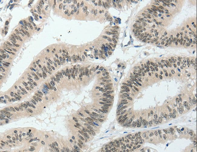 HNF1B / HNF1 Beta Antibody