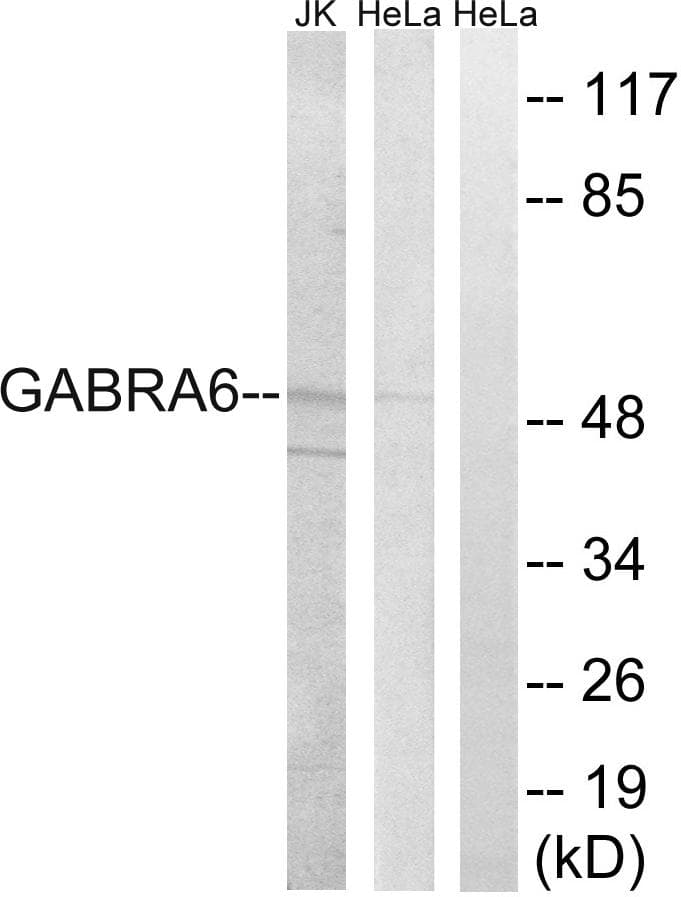 GABRA6 Antibody