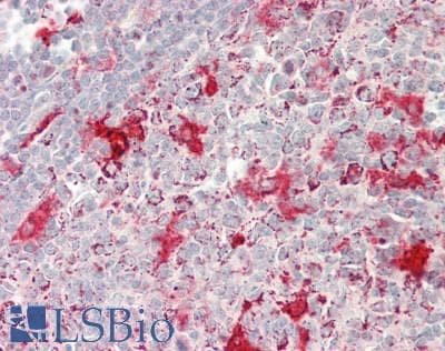 IHC-plus™ Polyclonal Rabbit anti-Human Properdin / CFP Antibody (IHC, IF, WB)