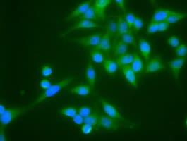 TNNI3 / Cardiac Troponin I Antibody (clone OTI4E5)
