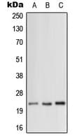 Polyclonal Rabbit anti-Human MRPL12 Antibody (Internal, WB)