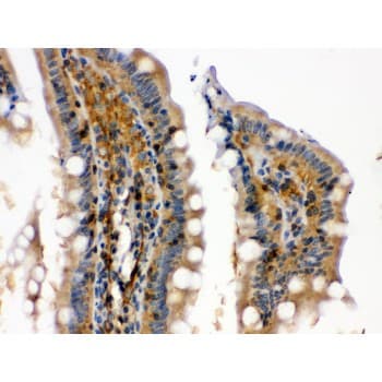 Polyclonal Rabbit anti-Human RAB13 Antibody (aa121-150, IHC, WB)