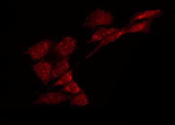 GABRA6 Antibody