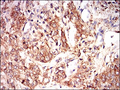 EIF2A / EIF2 Alpha Antibody (aa448-576, clone 3A7B11)