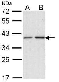 NAT2 Antibody