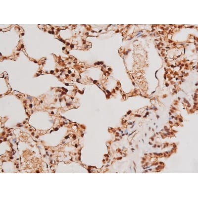 STAT3 Antibody (phospho-Tyr705)