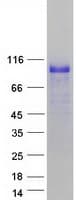 Human HIC1 Protein (Recombinant Myc-DDK (Flag))