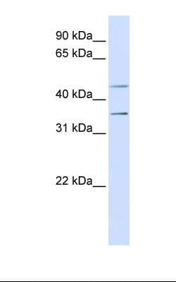 P2RY1 / P2Y1 Antibody (aa71-120)