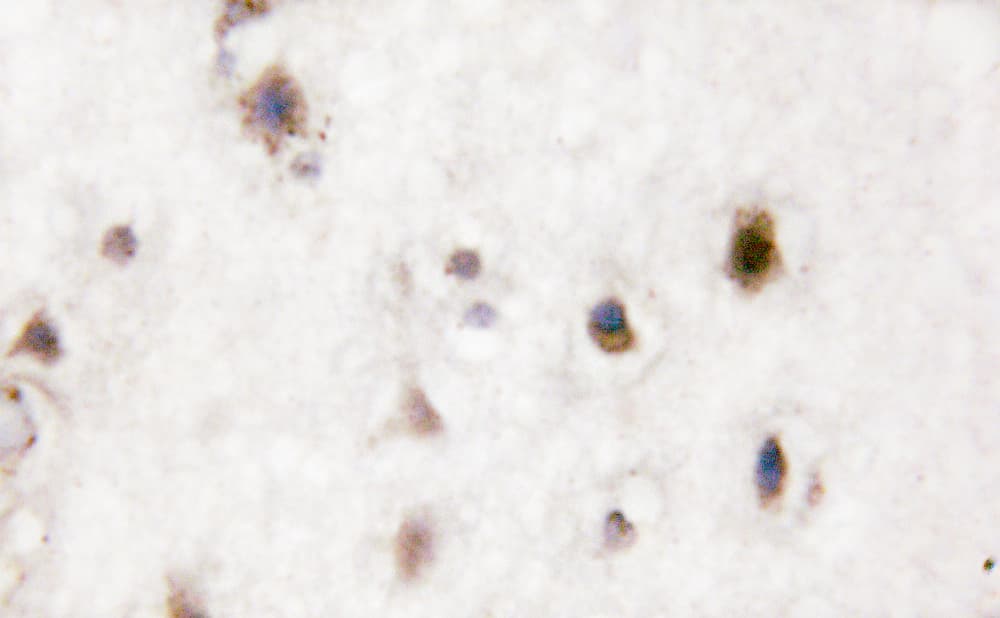 Polyclonal Rabbit anti-Human MAPK14 / p38 Antibody (phospho-Tyr323, IHC, IF, WB)