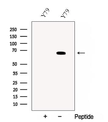 CRY2 Antibody