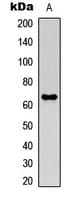 MMP21 Antibody (Internal)