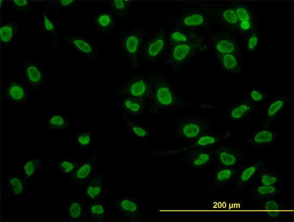 Monoclonal Mouse anti-Human TAF11 Antibody (clone 2G9, IHC, IF, WB)