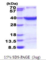 Human HSF2BP Protein (Recombinant His)