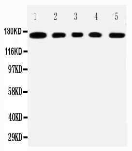 EMA / MUC1 Antibody (aa1067-1083)
