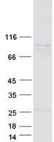 Human KIF9 Protein (Recombinant Myc-DDK (Flag))