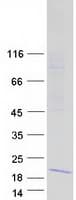 Human IFITM5 Protein (Recombinant Myc-DDK (Flag))