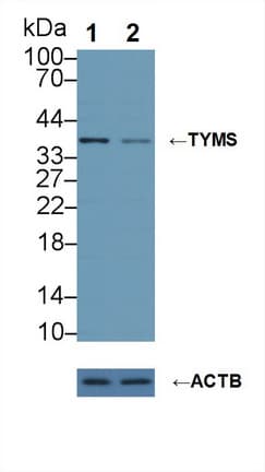 TS / Thymidylate Synthase Antibody (aa36-313)