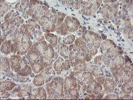 ARL2BP / BART Antibody (clone OTI1A10)
