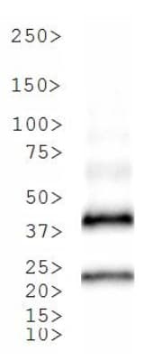 Tet Repressor Antibody