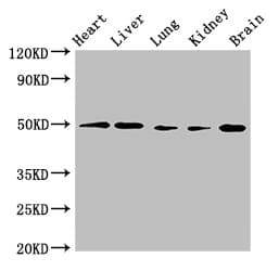 Polyclonal Rabbit anti-Human GPR22 Antibody (IF, WB)