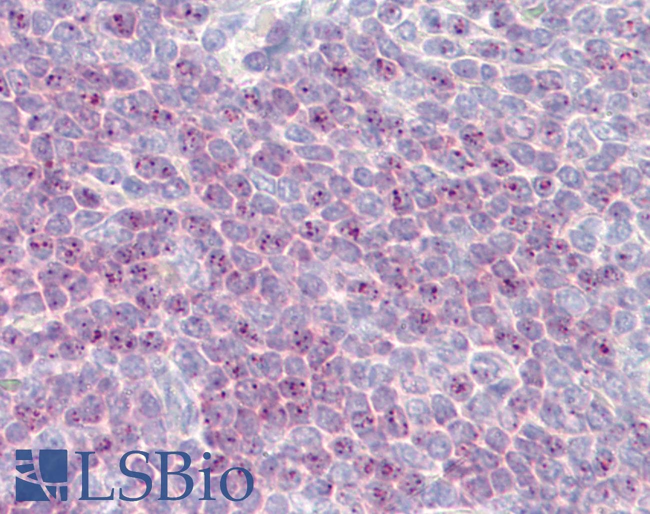 IHC-plus™ DLL1 Antibody (aa640-700)