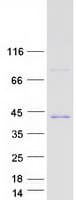 Human MED4 Protein (Recombinant Myc-DDK (Flag))