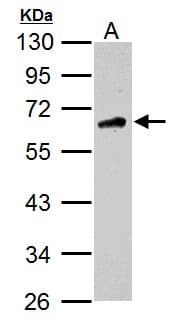 CAMKK2 Antibody (aa1-498)