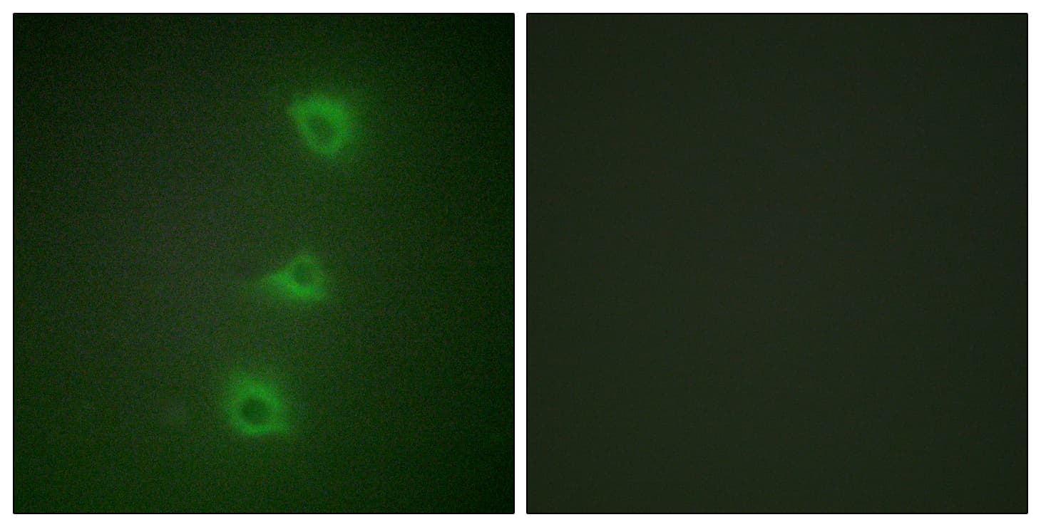 IHC-plus™ BRAF / B-Raf Antibody (aa171-220)