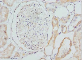 CYP4V2 Antibody
