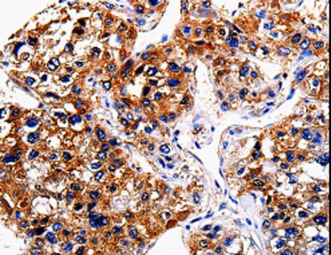 Polyclonal Rabbit anti-Human BRUCE / BIRC6 Antibody (IHC)
