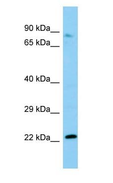 NOP2 Antibody (N-Terminus)