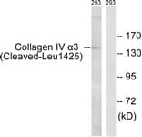 COL4A3 / Tumstatin Antibody (aa1376-1425)