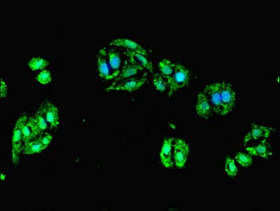 Polyclonal Rabbit anti-Human DCX / Doublecortin Antibody (IHC)