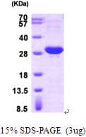 Human HSPB1 / HSP27 Protein (Recombinant His)